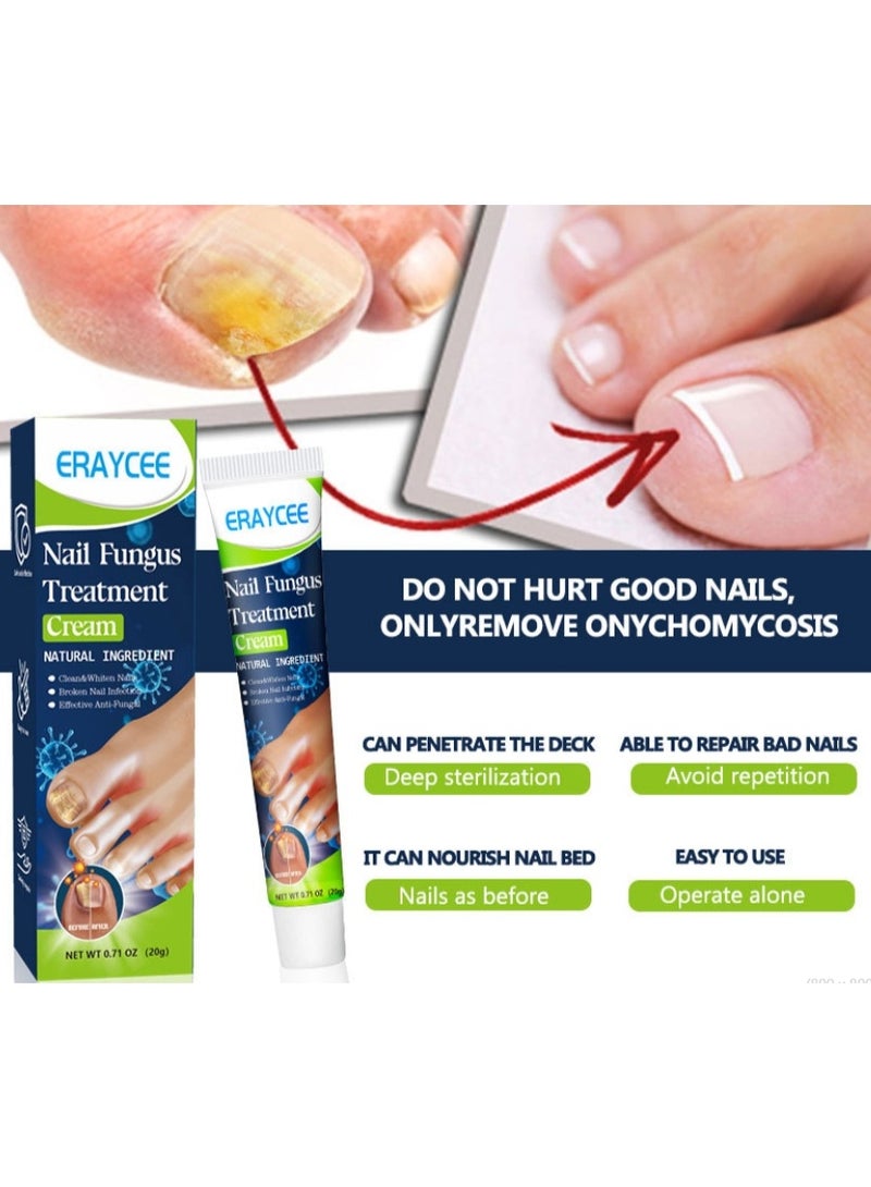 ERAYCEE Nail Fungus Treatment Cream, 20g Toenail Fungus Treatment Cream - Image 2